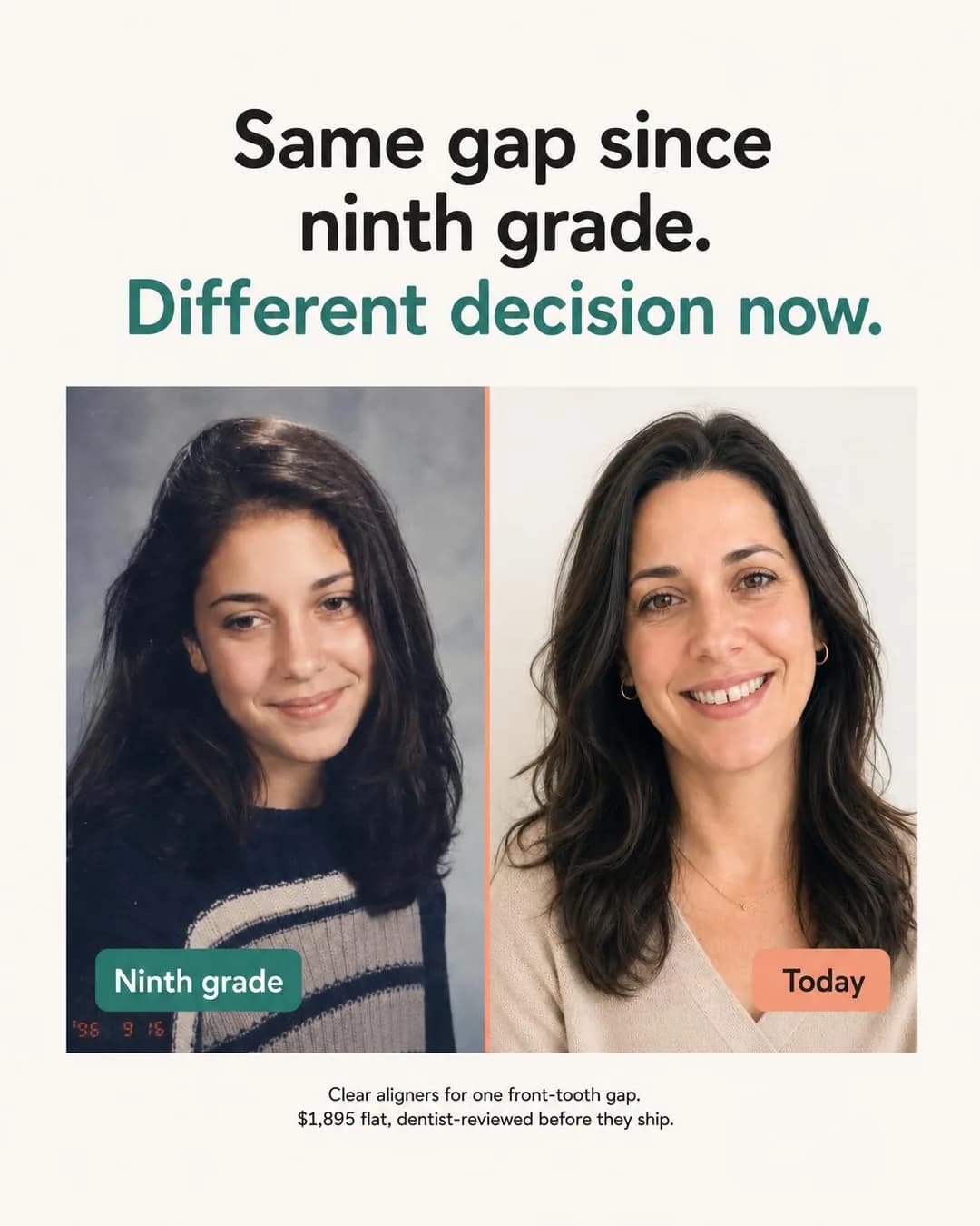 Before/after split, portrait 4:5. Anchors trust in time itself: a concern this old only closes when the fix is proven, flat-priced, and dentist-checked before it ships.