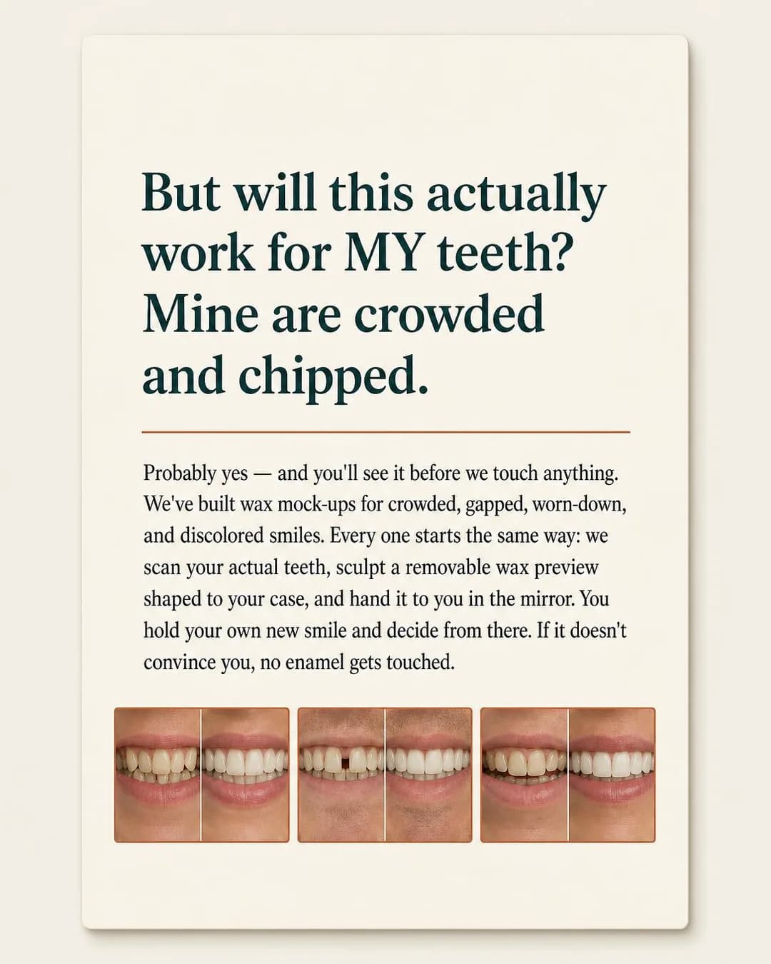 FAQ / objection-handling card, portrait 4:5. Skeptics don't ask if the process works in general, they ask if it works for their specific mouth, so showing the full range of starting points removes that doubt case by…