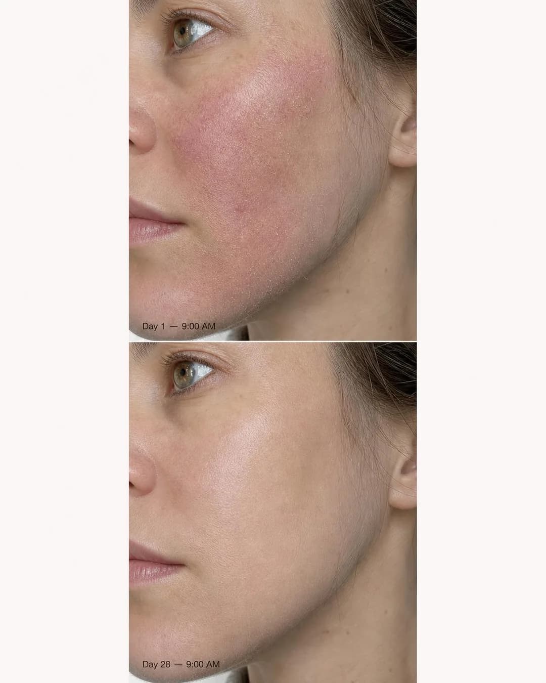 Before/after split, portrait 4:5. Unretouched 28-day documentation shows how bio-identical ceramides rebuild rough winter skin where topical oils merely sit.